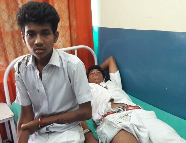 बांदा के पीलीकोठी में सेंटमैरी स्कूल के दो छात्रों पर गिरा हाईटेंशन विद्युत तार, बुरी तरह झुलसे, बच गई जान