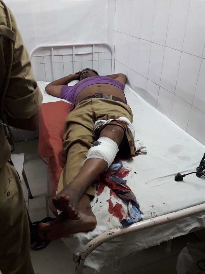 कानपुर में पुलिस मुठभेड़ में 25 हजार का ईनामी बदमाश घायल, दूसरा भाग निकला