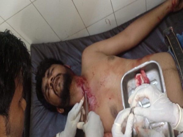 सीतापुर शहर में दिनदहाड़े युवक को मारीं दो गोलियां, दुस्साहसिक वारदात से फैली दहशत