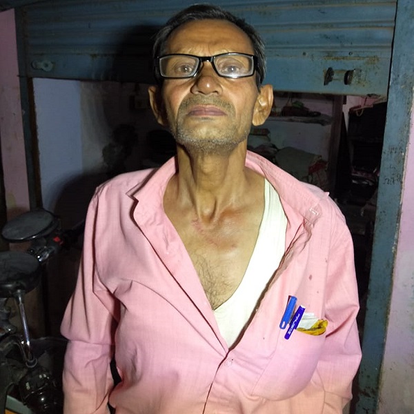 कानपुर के बर्रा में शाम को घर के बाहर बैठे अधिवक्ता से चेन लूट
