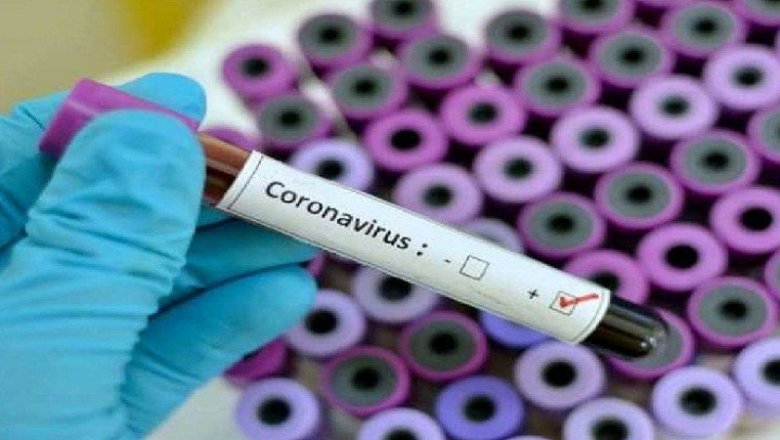 UP-COVID-19 : यूपी में लग सकता है नाइट कर्फ्यू , 170 प्रतिशत बढ़ा कोरोना वायरस