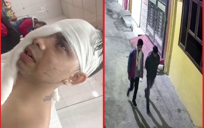 लखनऊ में मां-बेटे पर एसिड अटैक, घर में घुसकर दबंगों ने की वारदात- CCTV फुटैज खंगाल रही पुलिस