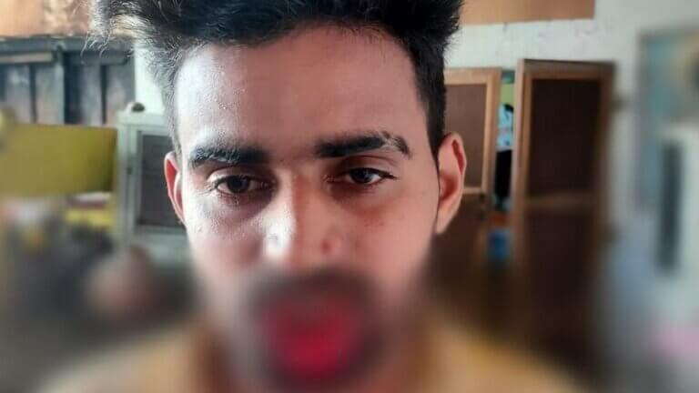 girl forcibly bitten lips of person who kissed her, FIR was also registered in Meeruth