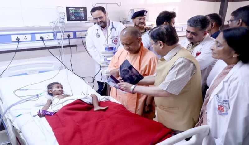 In Lucknow CM Yogi gave chocolate to injured girl, who was shot in Jeeva murder case 