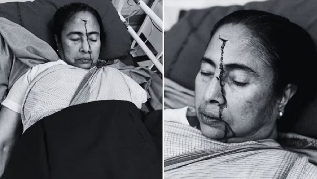 Bengal CM Mamata Banerjee seriously injured