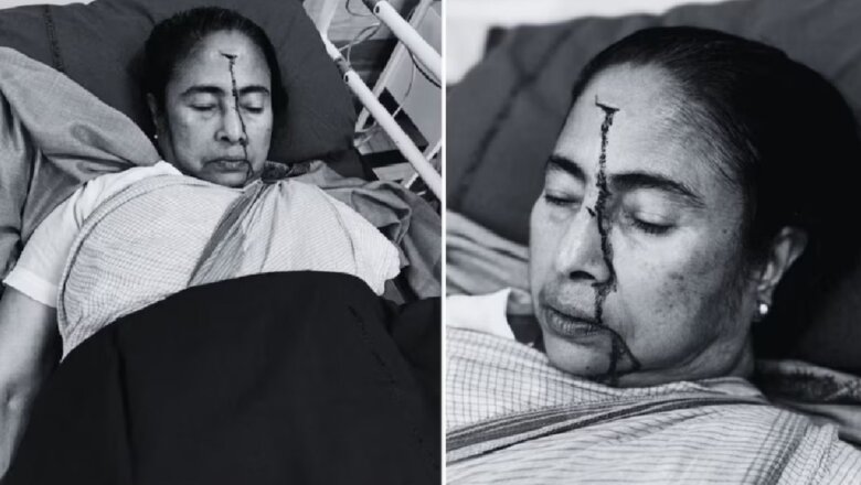 बंगाल की सीएम ममता बनर्जी गंभीर रूप से घायल, सिर में गंभीर चोट