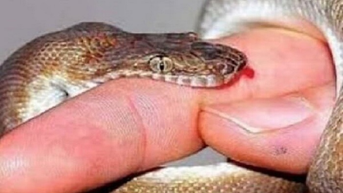 banda snake bit wife first, then husband