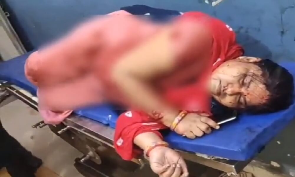 Husband attacked wife and father-in-law with sharp weapon in KaluKuan of Banda