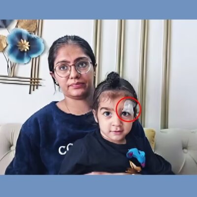 हद कर दी! मेरठ में डॉक्टर ने फेवीक्विक से चिपका दी बच्चे की चोट-मचा हड़कंप…CMO ने बैठाई जांच