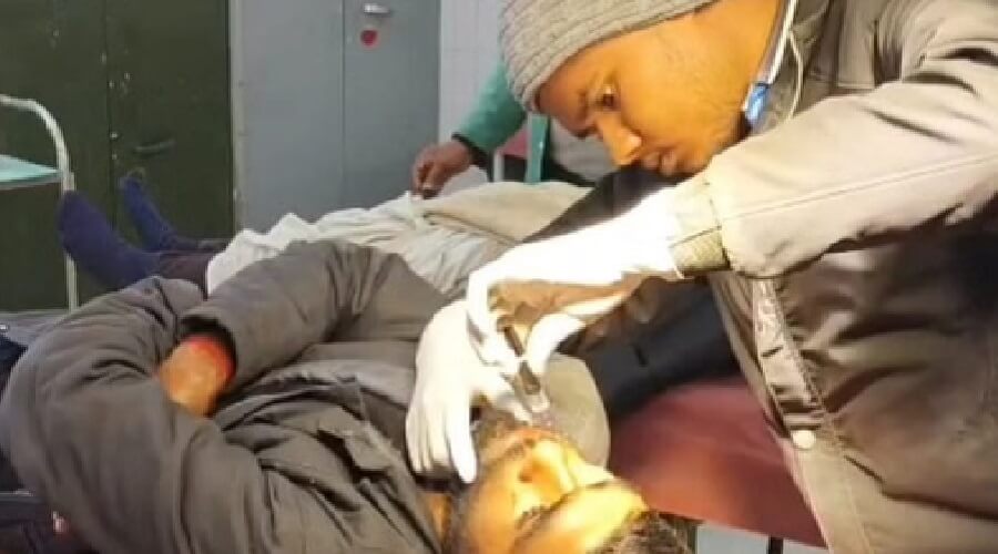 Prison battle: Murder accused bites gangster's cheek after being hit with cold water