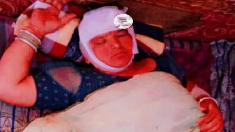 बांदा में दर्दनाक हादसे में पूजा को जा रहीं 16 महिलाएं-बच्चियां घायल