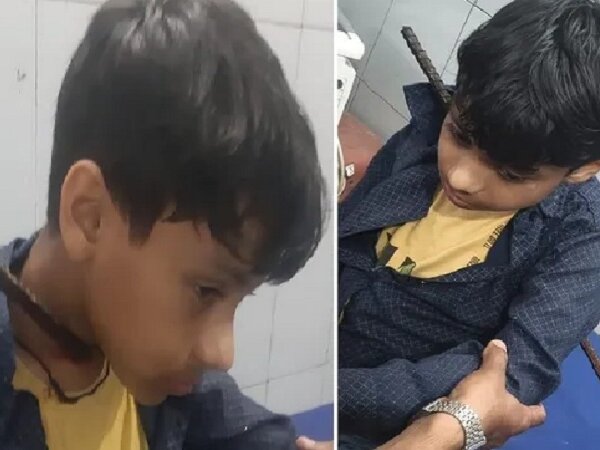 UP: बुलंदशहर के ऋषभ का हौंसला देख सभी हैरान-शरीर में सरिया, फिर भी..