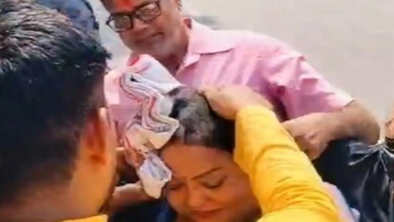 BJP महिला विधायक फूंक रहीं थीं अखिलेश यादव का पुतला-खुद झुलसीं-लखनऊ रेफर