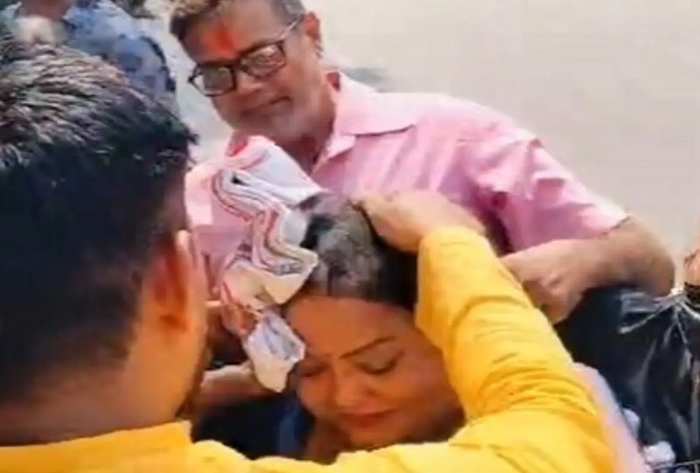 BJP MLA AnupamaJaiswal suffered burns while burning effigies of AkhileshYadav