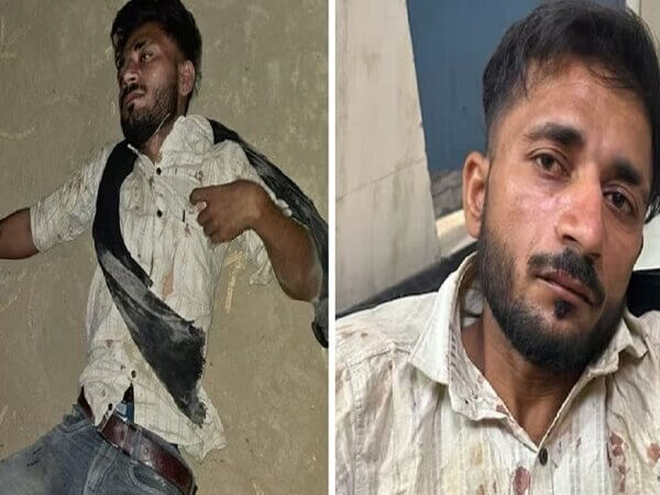 यूपी पुलिस भर्ती परीक्षा: युवतियों से रेप का प्रयास-एनकाउंटर में आरोपी हसीब गिरफ्तार
