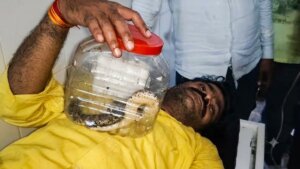 डिब्बे में बंद जिंदा सांप के साथ बांदा जिला अस्पताल में लेटा पीड़ित व्यक्ति
